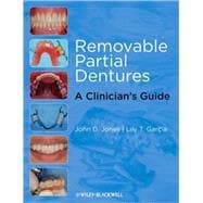 Removable Partial Dentures A Clinician's Guide