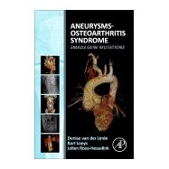 Aneurysms-Osteoarthritis Syndrome