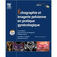 Échographie et imagerie pelvienne en pratique gynécologique