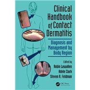 Clinical Handbook of Contact Dermatitis: Diagnosis and Management by Body Region