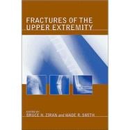 Fractures of the Upper Extremity