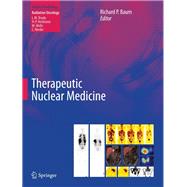 Therapeutic Nuclear Medicine