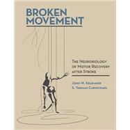 Broken Movement The Neurobiology of Motor Recovery after Stroke