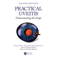 Practical Uveitis