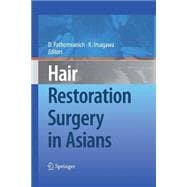 Hair Restoration Surgery in Asians