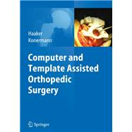 Computer and Template Assisted Orthopedic Surgery
