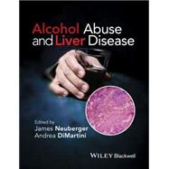 Alcohol Abuse and Liver Disease