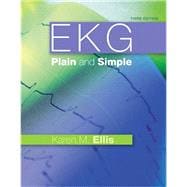 EKG Plain and Simple