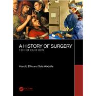 A History of Surgery