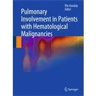 Pulmonary Involvement in Patients With Hematological Malignancies