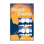 Handbook of Dental Trauma : A Practical Guide to the Treatment of Trauma to the Teeth