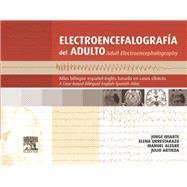 Electroencefalografía del adulto