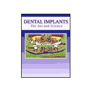 Dental Implants; The Art and Science
