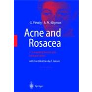 Acne and Rosacea