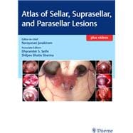 Atlas of Sellar, Suprasellar, and Parasellar Lesions