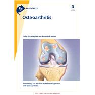 Fast Facts: Osteoarthritis