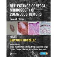 Reflectance Confocal Microscopy of Cutaneous Tumors