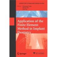 Application of the Finite Element Method in Implant Dentistry