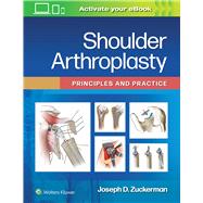 Shoulder Arthroplasty Principles and Practice