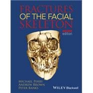 Fractures of the Facial Skeleton