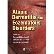 Atopic Dermatitis and Eczematous Disorders