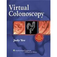 Virtual Colonoscopy