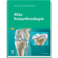 Atlas Kniearthroskopie