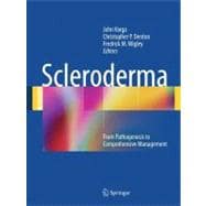 Scleroderma