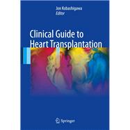Clinical Guide to Heart Transplantation,9783319437736