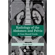 Radiology of the Abdomen and Pelvis