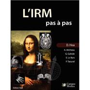 L'irm Pas a Pas: Edition Noir & Blanc