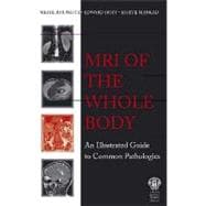 MRI of the Whole Body: An Illustrated Guide for Common Pathologies