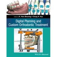 Digital Planning and Custom Orthodontic Treatment,9781119087779