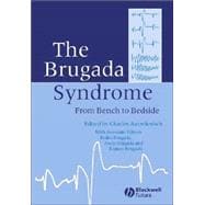 The Brugada Syndrome From Bench To Bedside