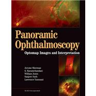 Panoramic Ophthalmoscopy Optomap Images and Interpretation