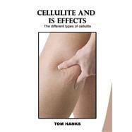 Cellulite and Is Effects: The Drawbacks of Cellulite