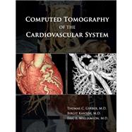 Computed Tomography of the Cardiovascular System