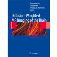 Diffusion-weighted Mr Imaging of the Brain