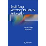 Small-gauge Vitrectomy for Diabetic Retinopathy