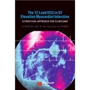 The 12 Lead ECG in ST Elevation Myocardial Infarction A Practical Approach for Clinicians