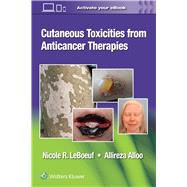 Cutaneous Toxicities from Anticancer Therapies