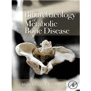The Bioarchaeology of Metabolic Bone Disease