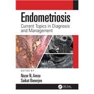 Endometriosis