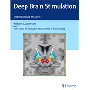 Deep Brain Stimulation