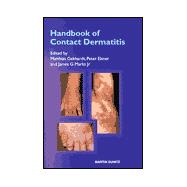 HANDBOOK OF CONTACT DERMATITIS