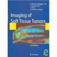 Imaging of Soft Tissue Tumors