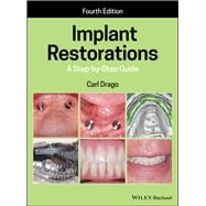 Implant Restorations A Step-by-Step Guide
