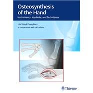 Osteosynthesis of the Hand