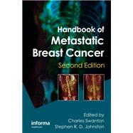 Handbook of Metastatic Breast Cancer, Second Edition