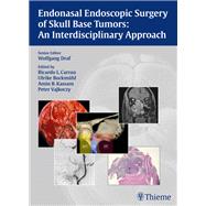Endonasal Endoscopic Surgery of Skull Base Tumors: An Interdisciplinary Approach